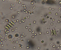 Scenedesmus