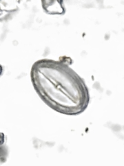 Cocconeis