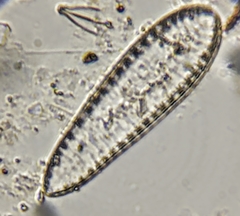 Surirella
