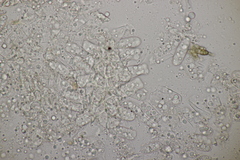 Taphrina tosquinetii