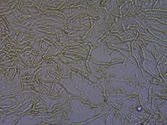 Clavulinopsis corniculata