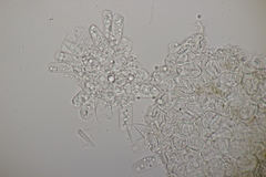 Taphrina tosquinetii