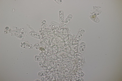 Taphrina tosquinetii