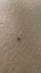 Amblyomma americanum