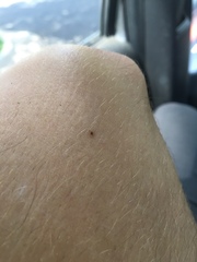 Amblyomma americanum