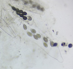 Podospora pyriformis
