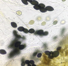Podospora pyriformis
