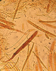 Hymenoscyphus caudatus