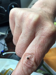 Brachiacantha decempustulata