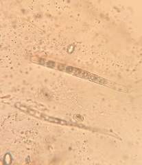 Scutellinia umbrorum