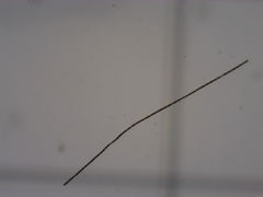 Dolichospermum planctonicum