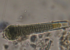 Calothrix