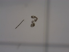 Dolichospermum planctonicum