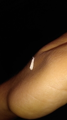 Haimbachia squamulellus