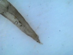 Lepidoziaceae