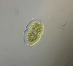 Cosmarium pseudopyramidatum