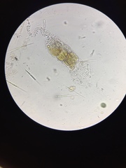 Collotheca heptabrachiata