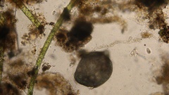 Stentor coeruleus