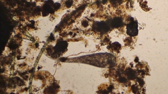 Stentor coeruleus