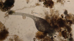 Stentor coeruleus