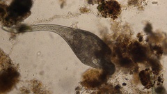 Stentor coeruleus