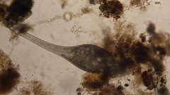 Stentor coeruleus