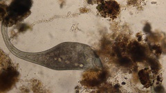 Stentor coeruleus