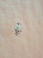 Deraeocoris lutescens