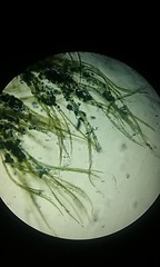 Pseudanabaena limnetica