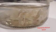 Diphyllobothrium latum