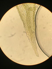 Lescuraea radicosa radicosa