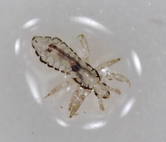 Pediculus humanus
