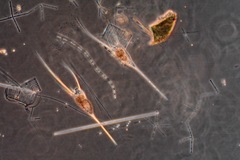 Kellicottia longispina