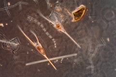 Kellicottia longispina