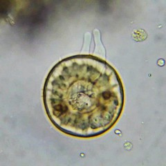Arcella hemisphaerica