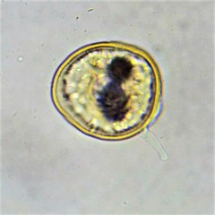 Arcella hemisphaerica