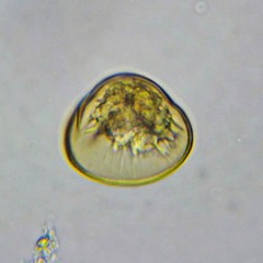 Arcella hemisphaerica