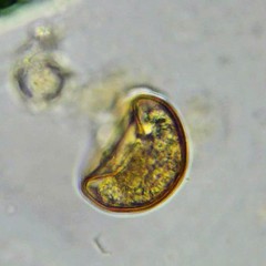 Arcella hemisphaerica