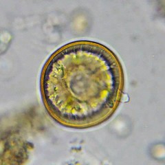 Arcella hemisphaerica