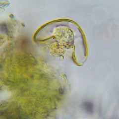 Arcella hemisphaerica