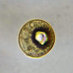 Arcella hemisphaerica