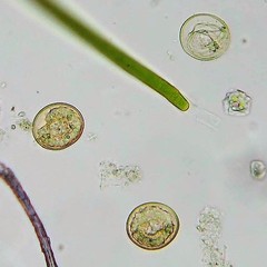 Arcella hemisphaerica