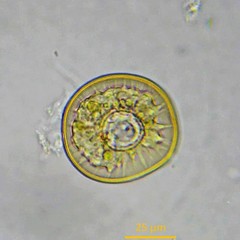 Arcella hemisphaerica