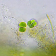 Chroococcus turgidus