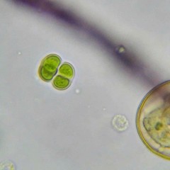 Chroococcus turgidus