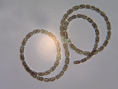 Anabaena