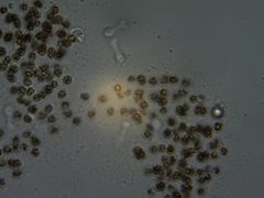 Microcystis