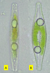 Navicula cryptocephala