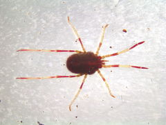 Erythraeoidea