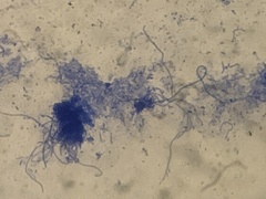 Bacillus cereus